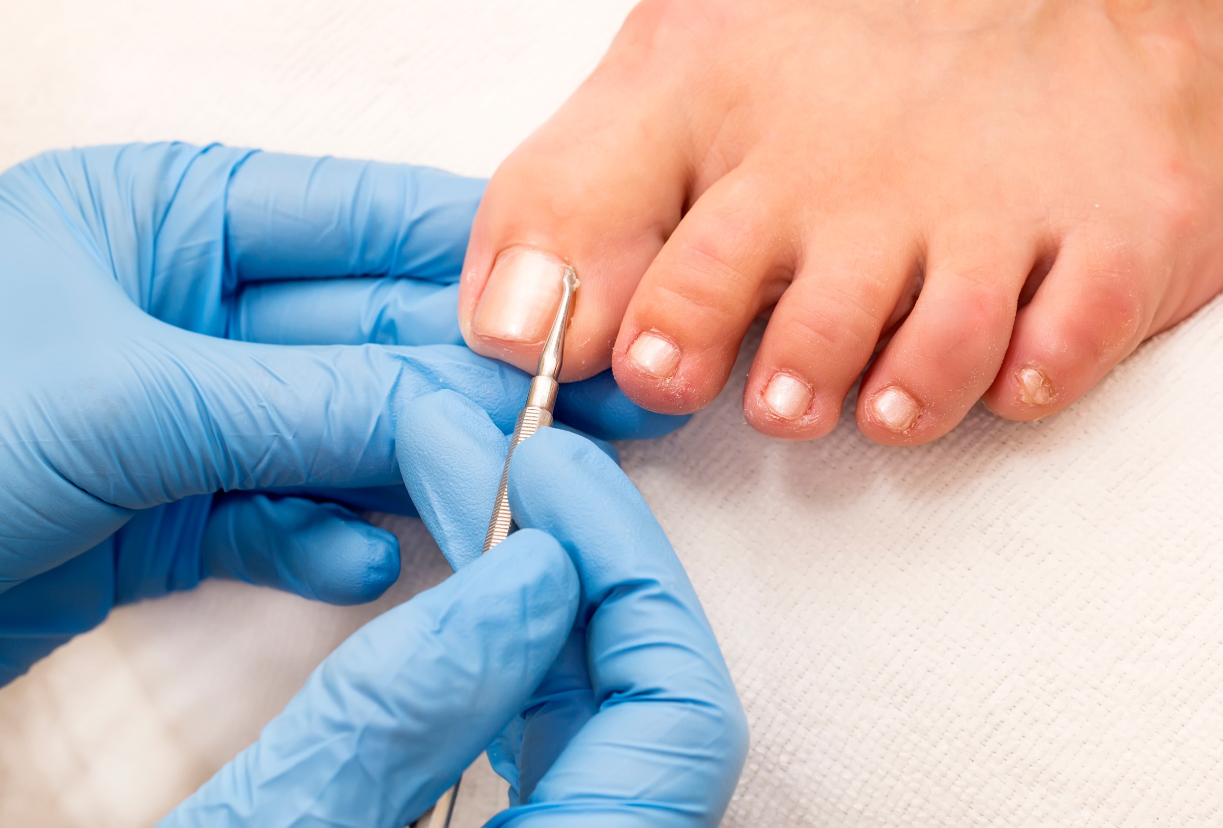 Pedicura